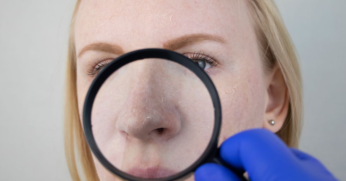 A szomjazó bőr jelei