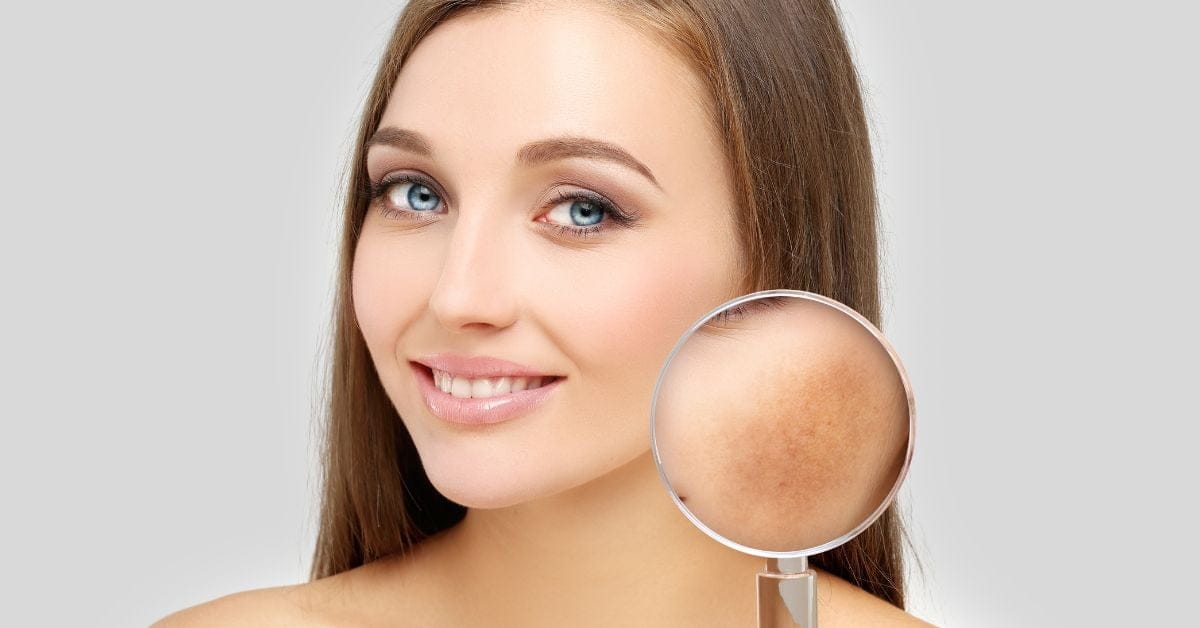 Hogyan alakulnak ki a májfoltok?