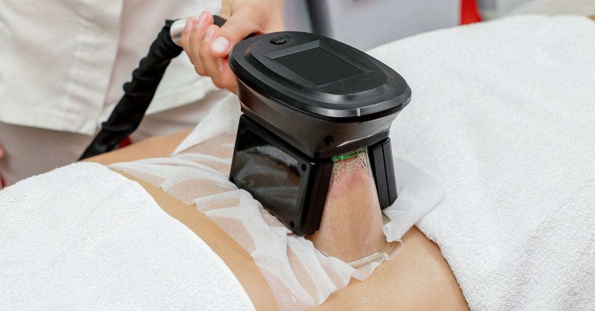 Bemutatjuk a kriolipolízist, a zsírleszívás biztonságos és nem műtéti alternatíváját