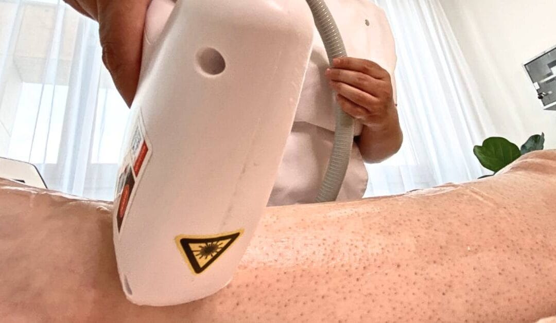 Mindent, amit tudni szeretnél a lézeres szőrtelenítésről!