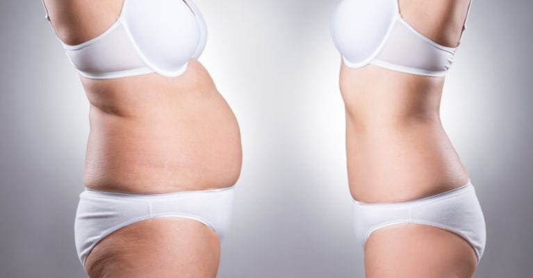 Az eredmény? Látványos fogyás, diéta és műtét nélkül!