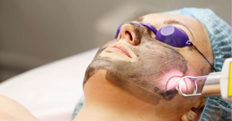 A  carbon peeling kezelés gyors, fájdalommentes és általában mindössze 20-30 percet vesz igénybe.