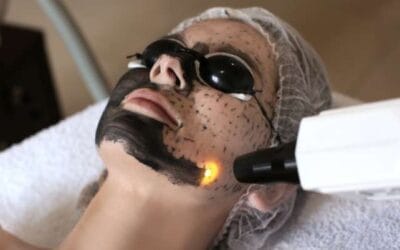 Tiszta, ragyogó bőr titka: Carbon peeling kezelés Érden