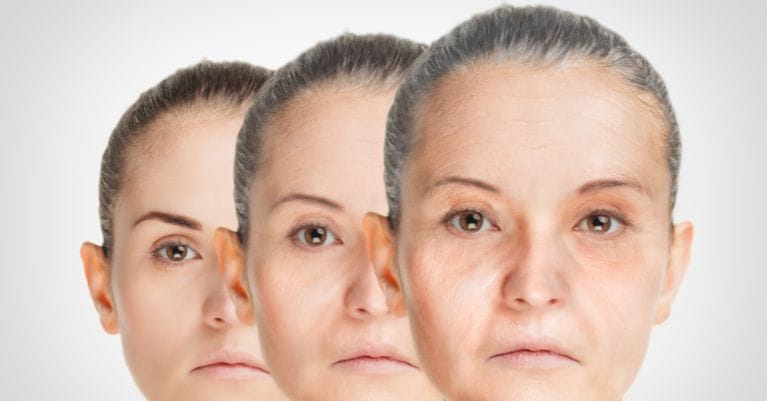 A bőr és a glikáció: A szépség biokémiája