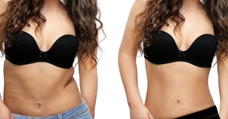 Gyors és tényleg hatékony alakformáló megoldást keresel?