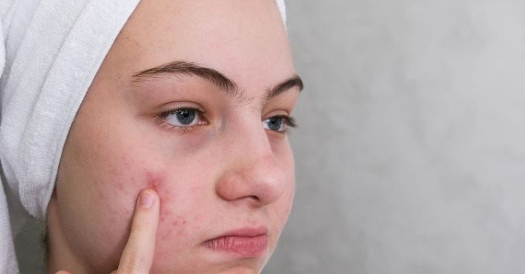 Bőrkezelések hatása