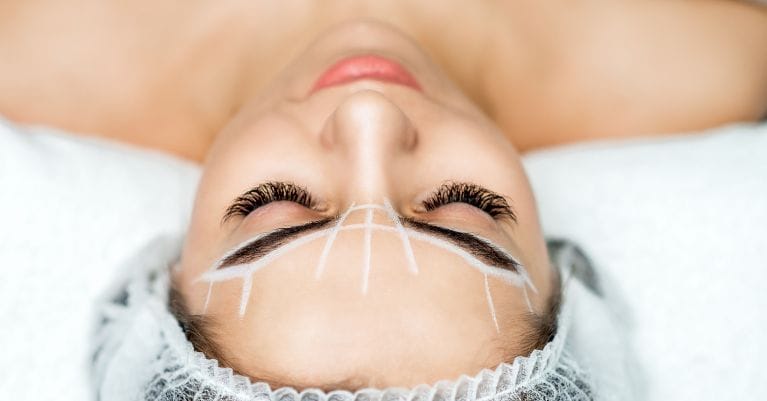 A Goink tetoválás eltávolítási eljárásról