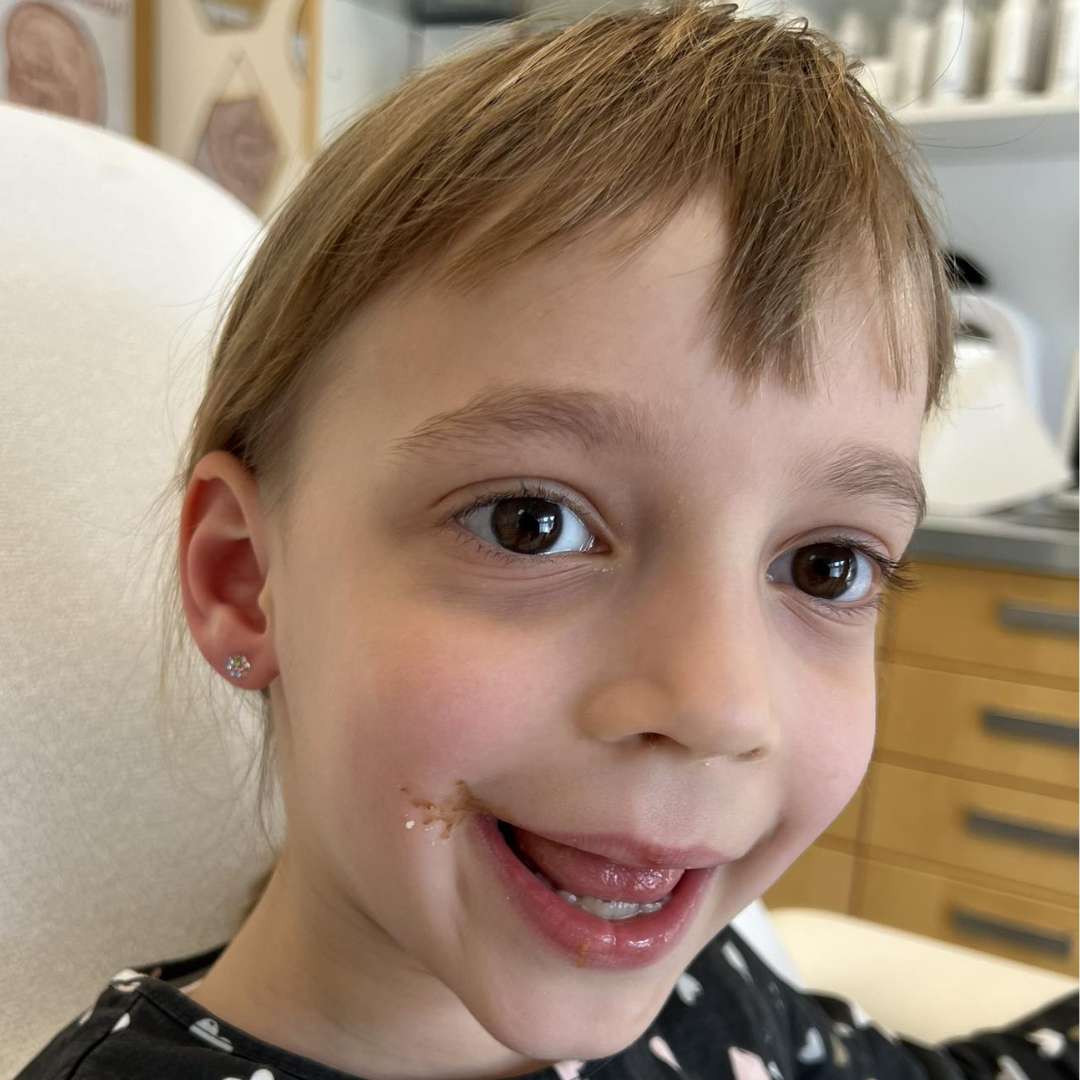 Blomdahl fülbevalók-ÉRD (1) Blomdahl fülbevalók