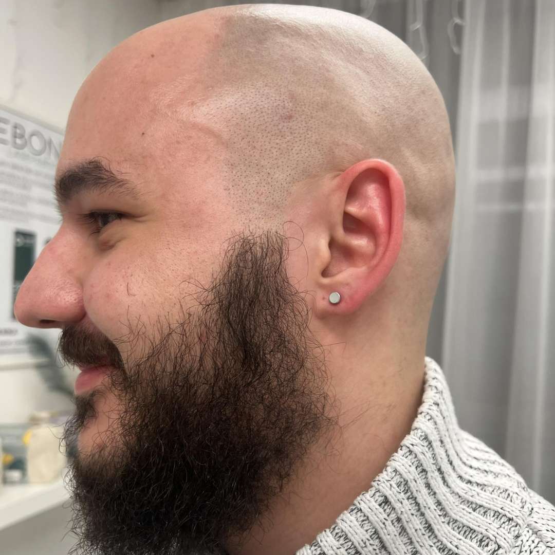 Blomdahl fülbevalók-ÉRD Blomdahl fülbevalók