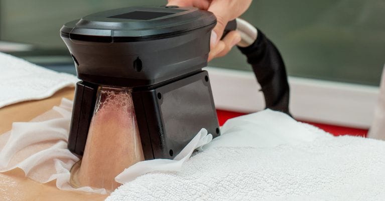 Zsírfagyasztásos alakformálás előnyei Érden