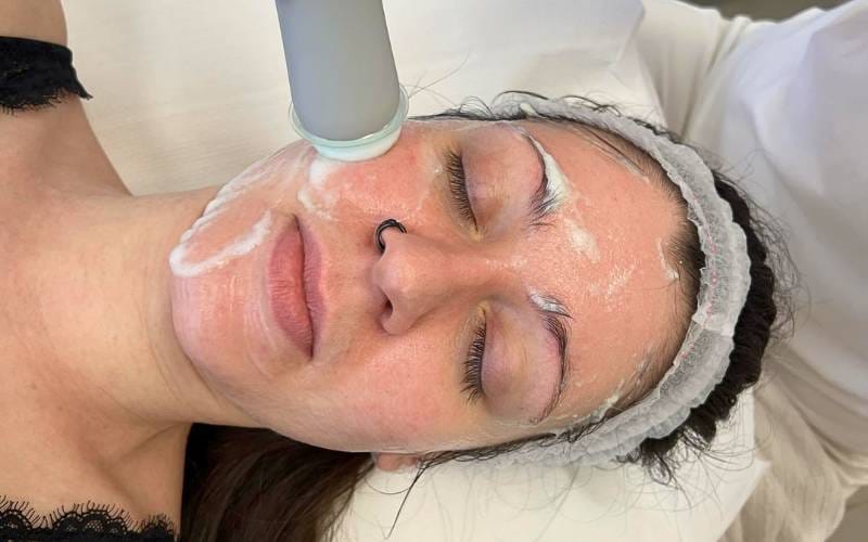 A kozmetikai hámlasztás fontossága a bőrápolásban