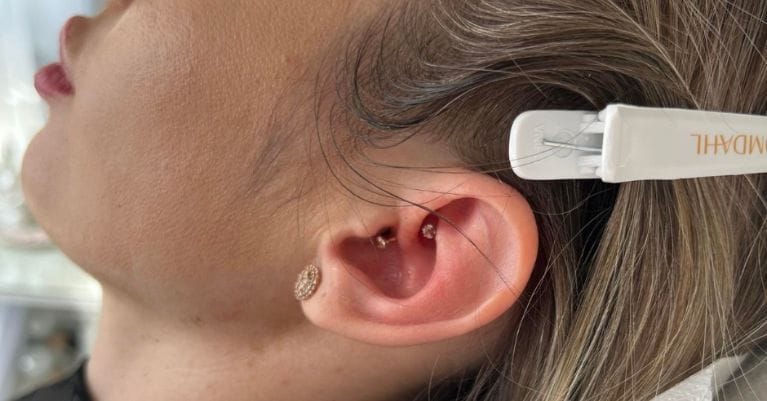 Fülakupunktúra: Az Ebony Szépségszalonban Érden különleges figyelmet fordít a testi-lelki harmónia helyreállítására