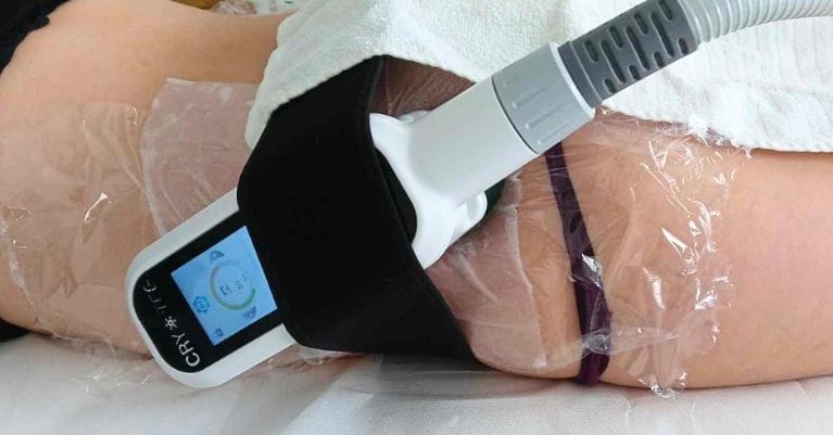 Zsírfagyasztás – A tökéletes alakformálás titka Érden