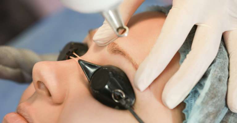 Új fejezet Érden: ND YAG Q-kapcsolt lézeres tetoválás eltávolítás