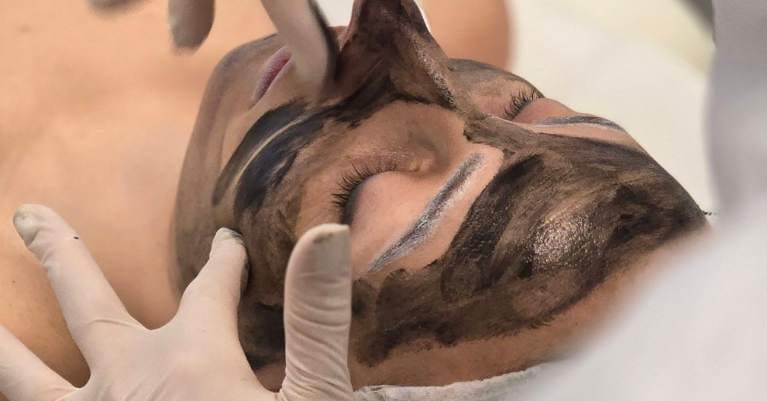 5 érdekesség a lézeres Carbon Peelingről