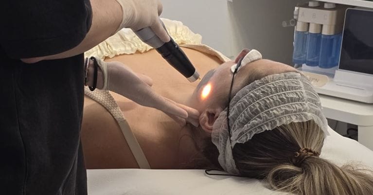 5 megdöbbentő tény a Carbon Peeling hatékonyságáról