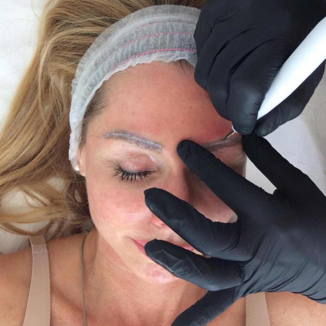 Goink tetoválás eltávolítás Érden (1) Goink tetoválás eltávolítás Érden