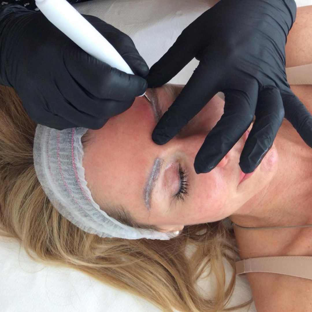 Goink tetoválás eltávolítás Érden Goink tetoválás eltávolítás Érden