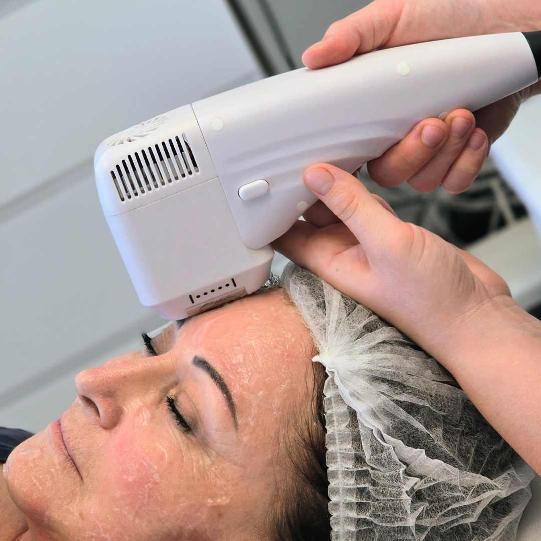 Hifu kezelés Érden Hifu kezelés Érden