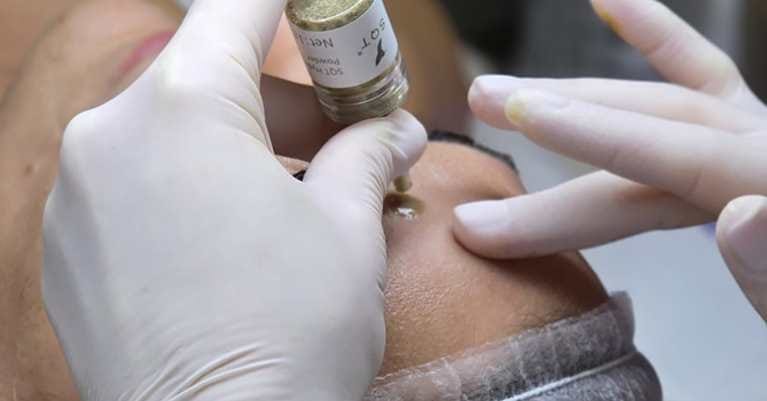 Az SQT kezelés: Természetes bőrfiatalítás Érden