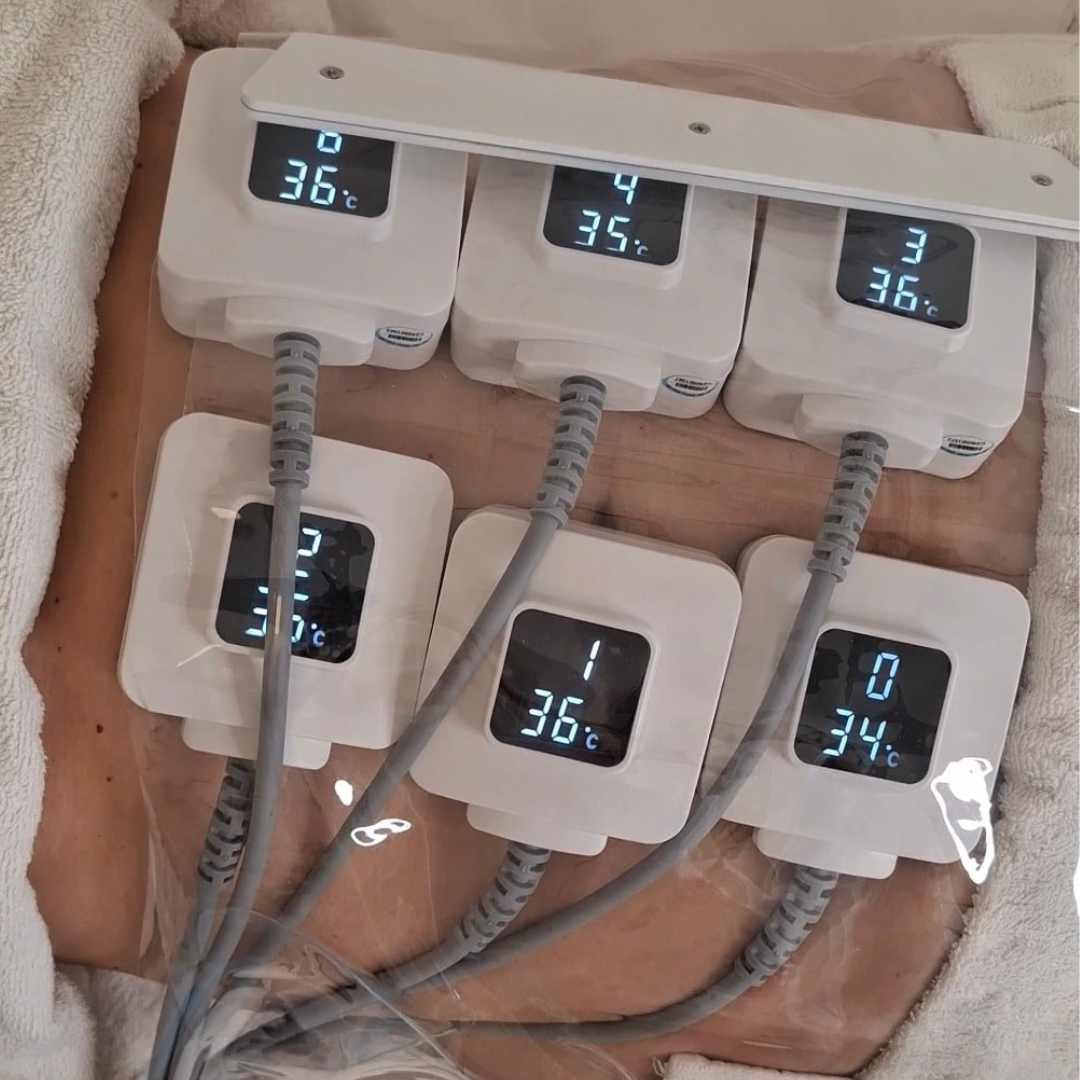 Monosculpt technológia bárki számára ajánlott, aki problémás zsírrétegekkel küzd Érden (1) Monosculpt technológia bárki számára ajánlott, aki problémás zsírrétegekkel küzd