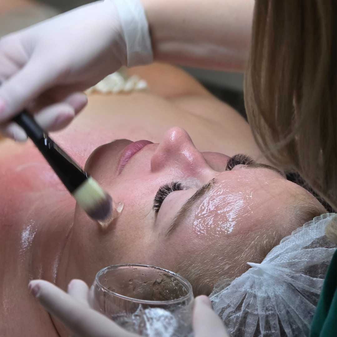 Savas hámlasztás érden