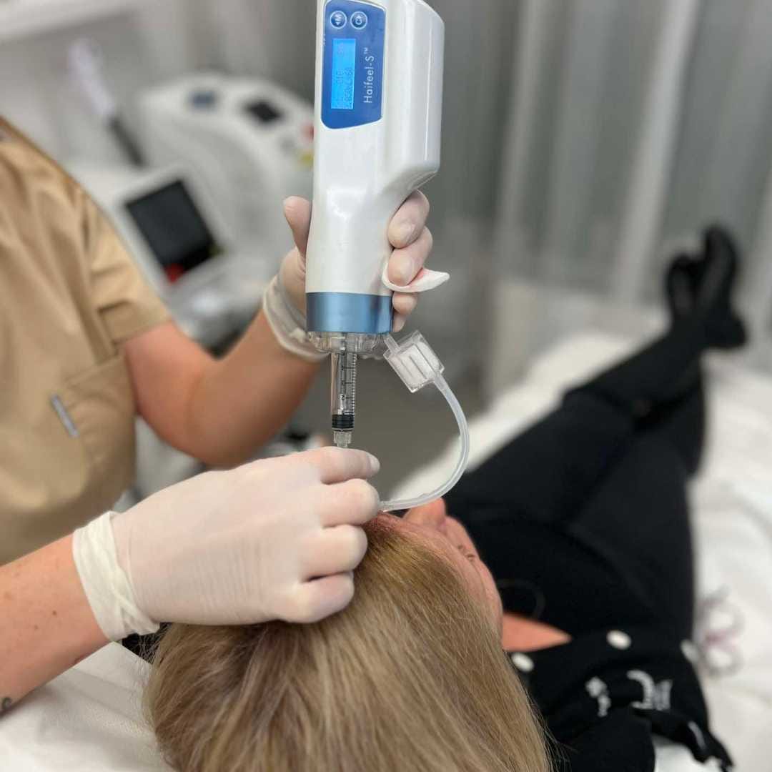 SkinBooster kezelés az Ebony Orvoskozmetikai szépségszalonban érden (1) SkinBooster kezelés az Ebony Orvoskozmetikai szépségszalonban érden