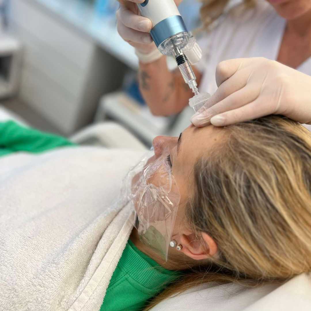 SkinBooster kezelés az Ebony Orvoskozmetikai szépségszalonban érden SkinBooster kezelés az Ebony Orvoskozmetikai szépségszalonban érden2