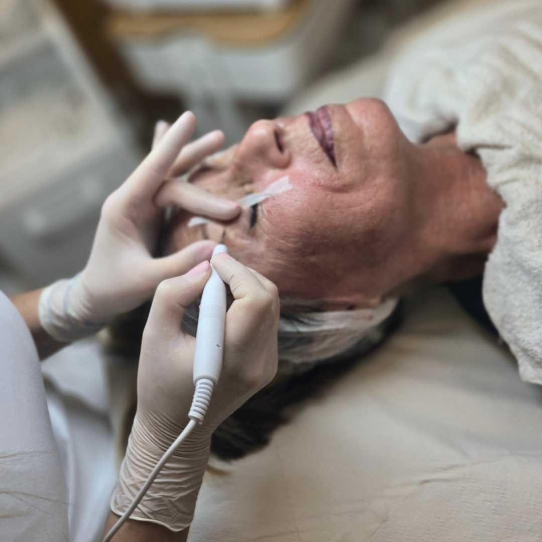 TERMIKUS IONIZÁCIÓ ÉRDEN