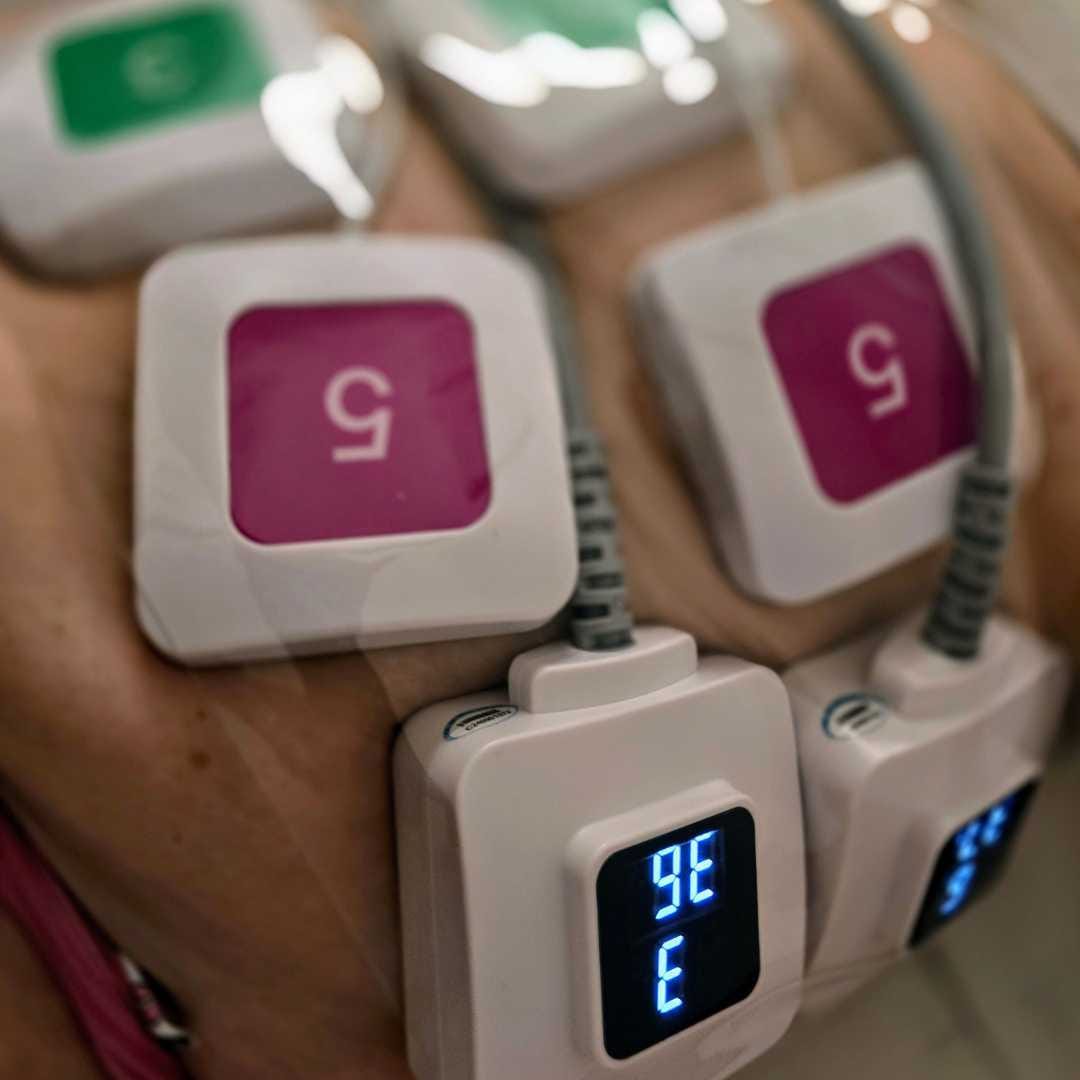 Trueshape ems alakformáló kezelés-Érd (2) Trueshape ems alakformáló kezelés-Érd