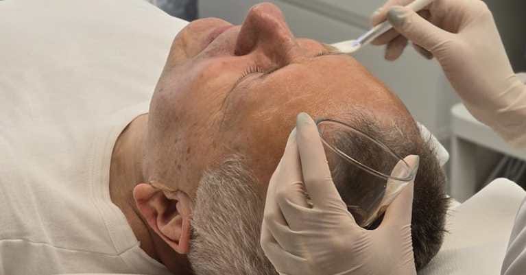 Kozmetikai kezelések férfiaknak Érden