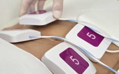 Amit az alakformálásról tudnod kell Érden a Monosculpt EMS-sel