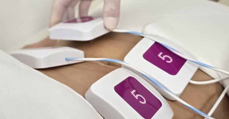 Amit az alakformálásról tudnod kell Érden a Monosculpt EMS-sel