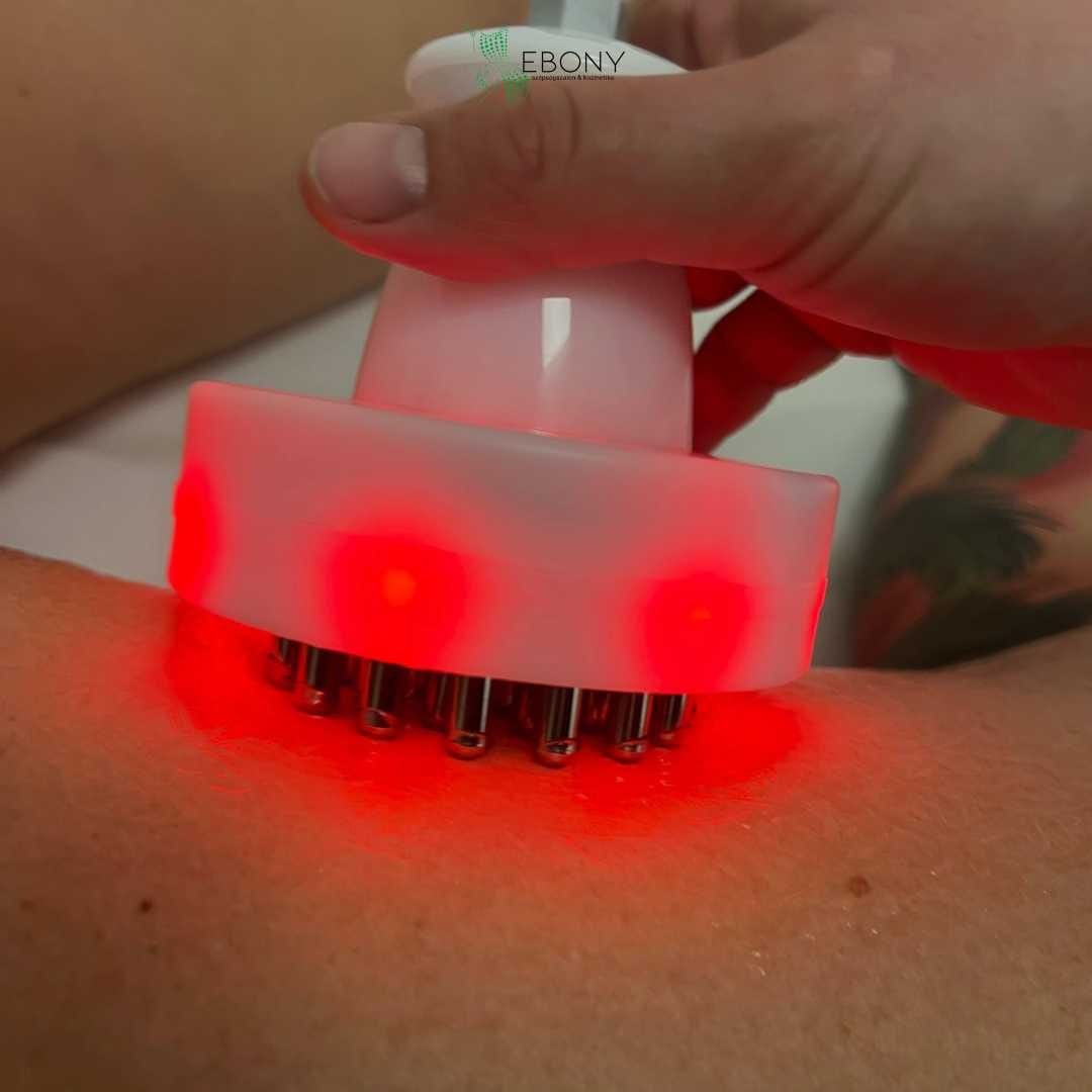 Ultrahangos kavitációs alakformáló kezelés Érden-szalon