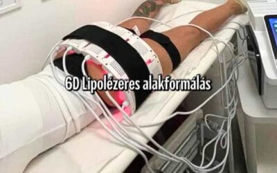 Hogyan működik a 6D Lipolézeres alakformálás Érden?