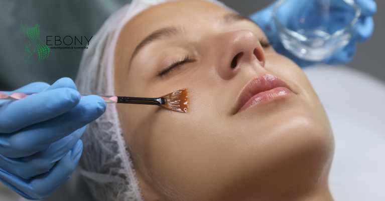 Bőrmegújítás savas hámlasztással – miért az ősz a legjobb időszak?