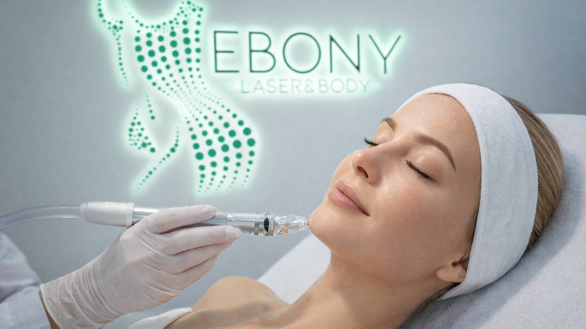 Bőrmegújító kezelés Érden – professzionális arckezelés európai nőn, Ebony Laser&Body szépségszalon