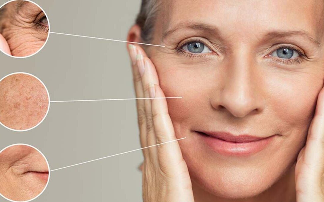 Miért öregszik a bőröd gyorsabban, mint kellene? – és mit tehetsz ellene Érden