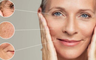 Miért öregszik a bőröd gyorsabban, mint kellene? – és mit tehetsz ellene Érden
