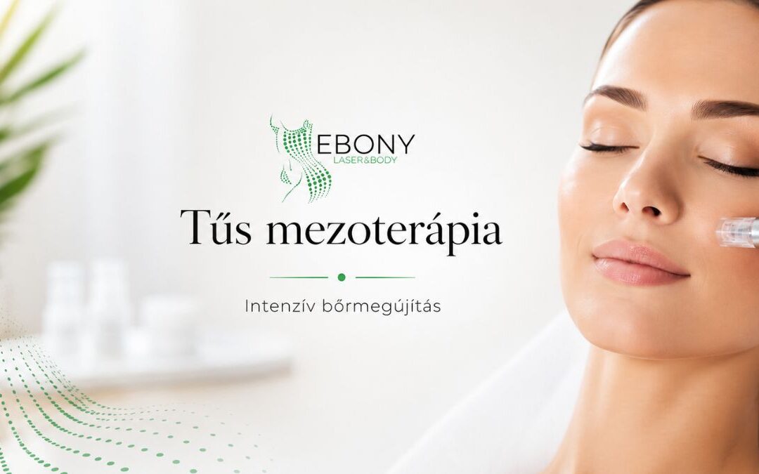 Tűs mezoterápia és microneedling: amikor a bőrödnek már intenzívebb megújulásra van szüksége
